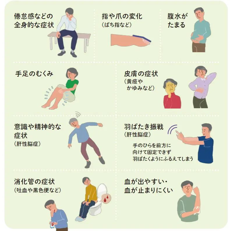 肝硬変 | 中村まさし内科クリニック