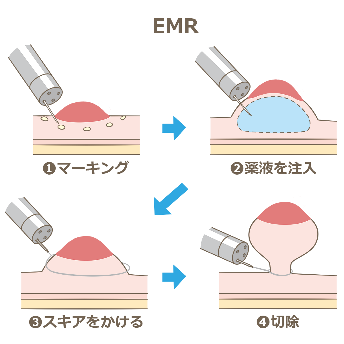 堺 市 ショップ 大腸 カメラ