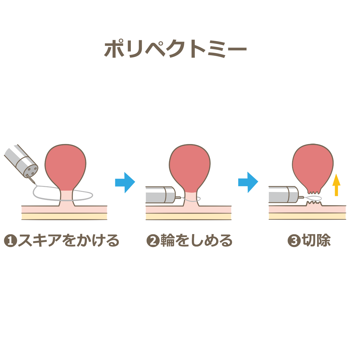 堺 市 ショップ 大腸 カメラ